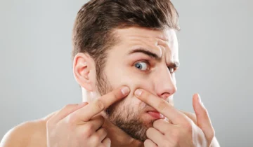 BOUTONS : 5 gestes à adopter pour limiter les imperfections sur votre peau ! 